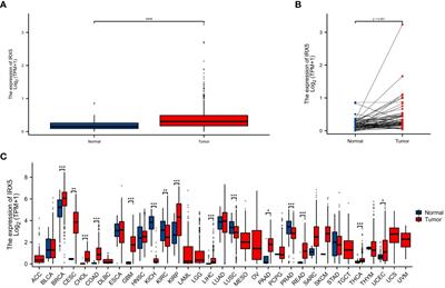 Frontiers | IRX5's influence on macrophage polarization and outcome in  papillary thyroid cancer